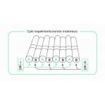 Anti-decubitus mattress pneumatic compartment 17 compartments with CPR safety valve