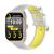 Colmi P86 Smartwatch (Χρυσό)